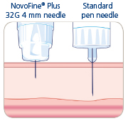 Novofine 0,23/0,25 X 6 mm 32G penkanyle